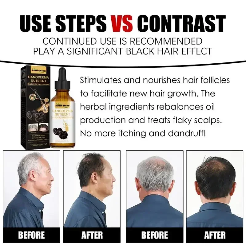 Hair Care Strengthen Hair Root – Hair Care Pantene recenzja i cena