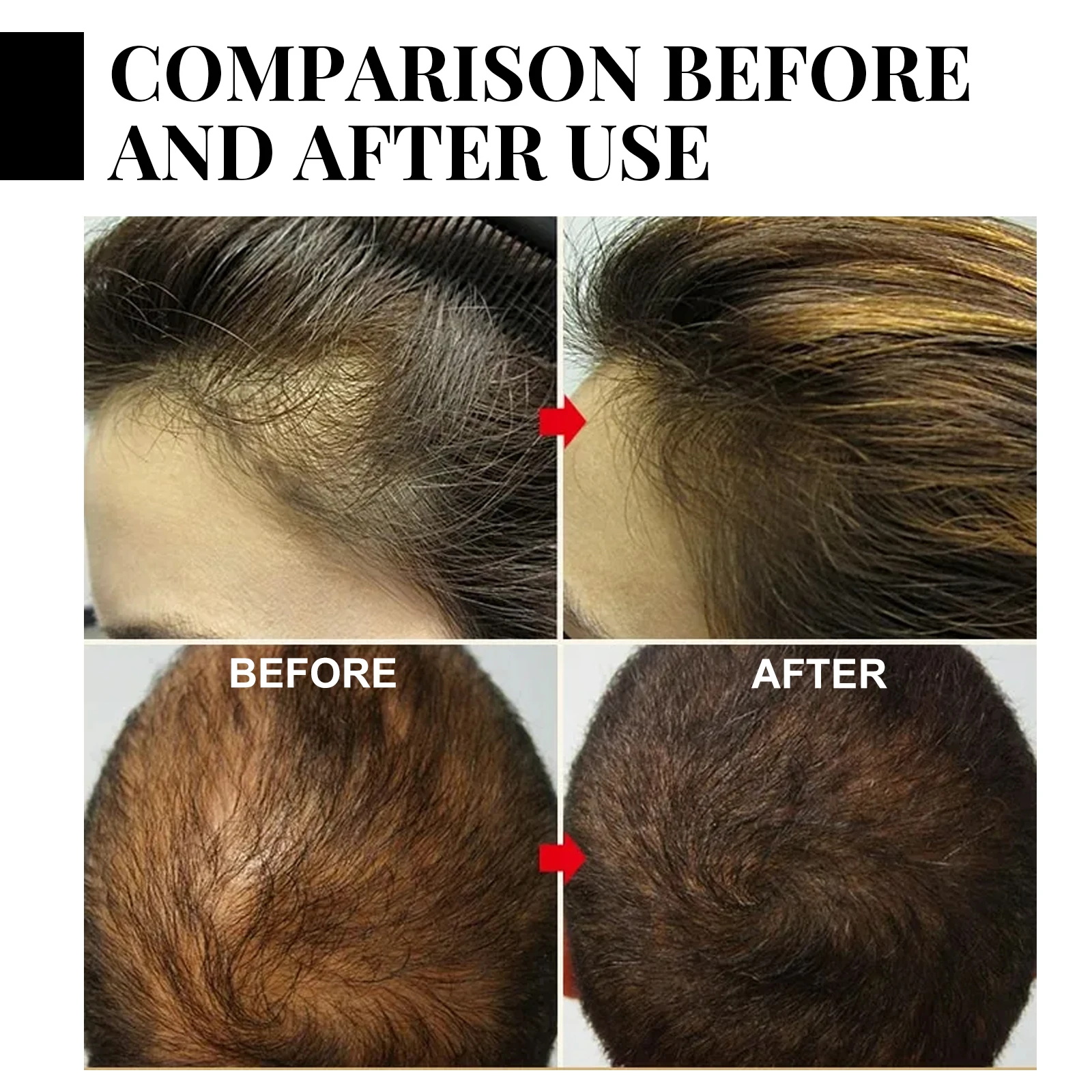 Ginger Hair Growth spray Anti  – Hair Care Herbal recenzja i cena
