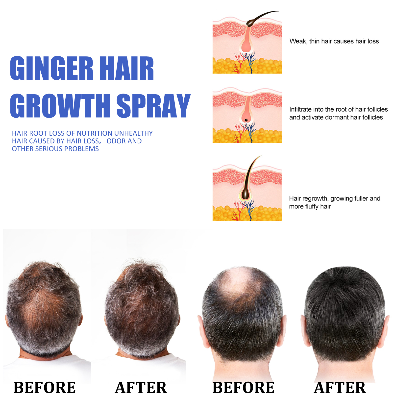 Ginger Hair Growth spray Anti  – Hair Care Herbal recenzja i cena
